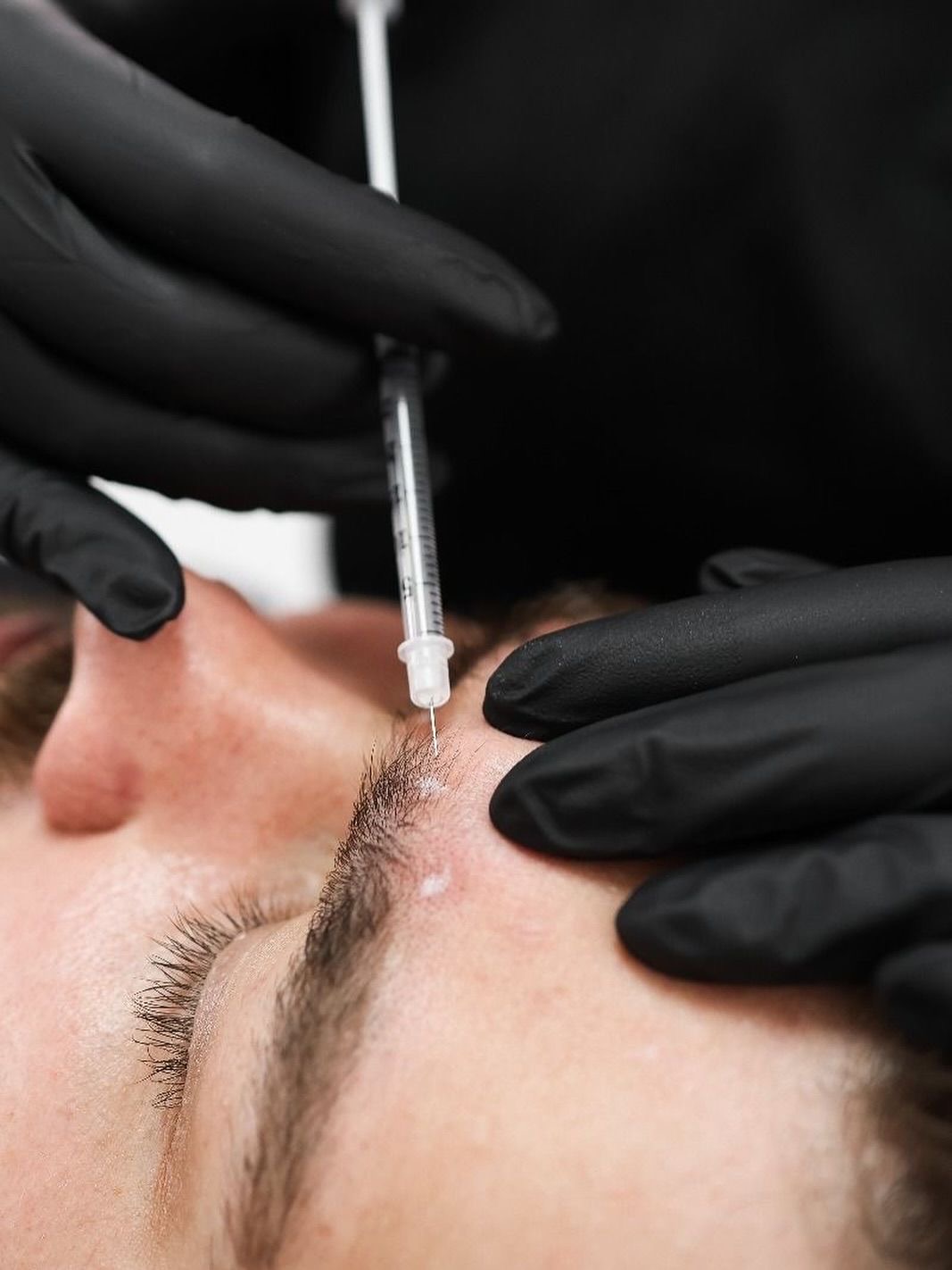 Botulinum Therapy (Botox)