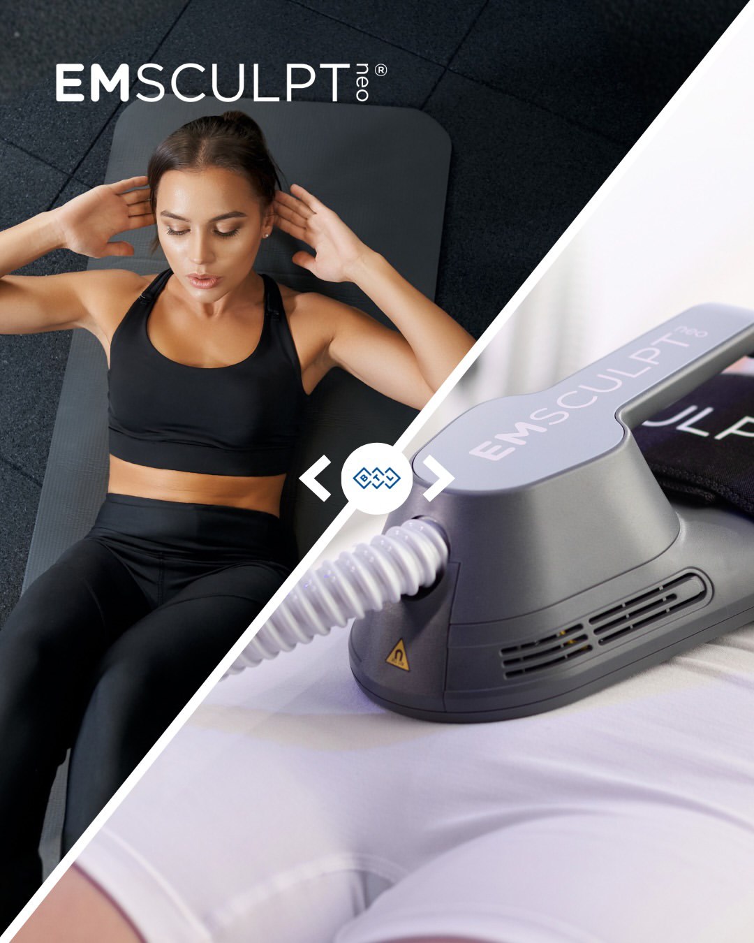 Non-Surgical BBL Brazilian Butt Lift Miami FL | Sculptra + EmSculpt